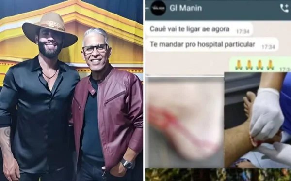 imagem colorida irmao gusttavo lima atacado macaco