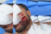 Imagens de câmeras de segurança mostram o instante em que o advogado Adonis Martins golpeia a vítima durante a festa Imagens de câmeras de segurança mostram o instante em que o advogado Adonis Martins golpeia a vítima durante a festa