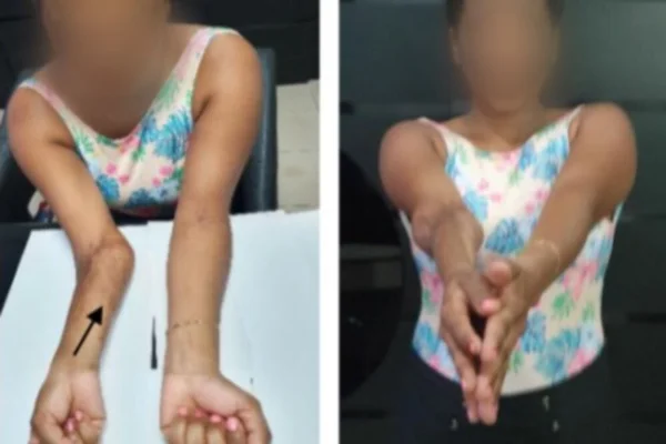 erro parto braço deformado goias (1)