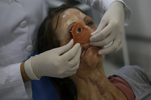 Ciência e amor: instituto faz campanha para reabilitação facial gratuita