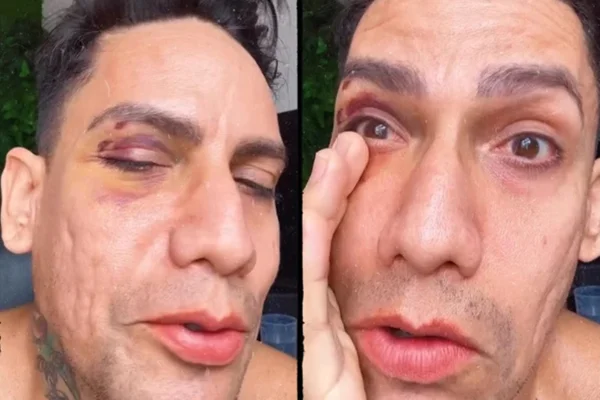 Jovem denunciou agressão durante carnaval no Recife