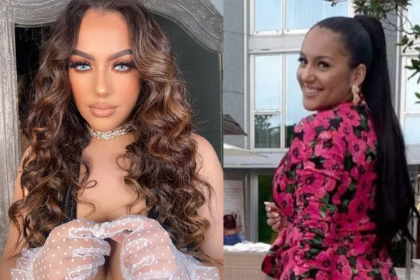 Montagem de fotos mostra antes e depois da modelo Layyons Valença que fez ceratopigmentação, procedimento que muda a cor do olho