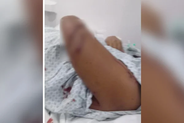 Grávida é atacada com cacos de vidro por namorada do ex-companheiro em GO