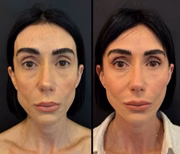 A jornalista Michelle Barros, de 46 anos