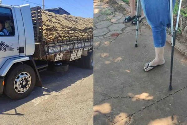 Foto colorida de motorista de caminhão sem uma das pernas - Metrópoles