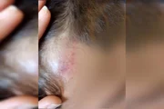 Lesão na testa