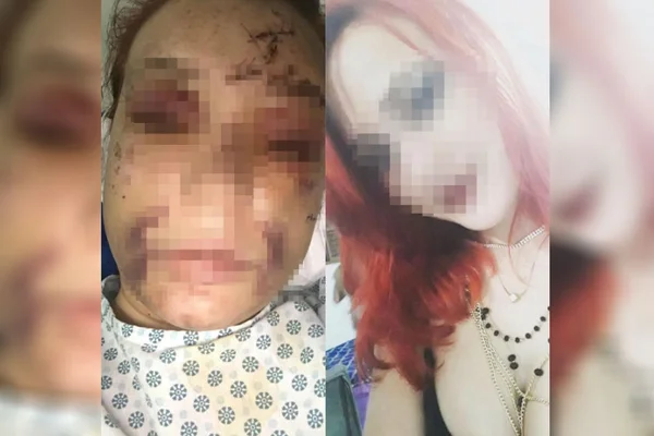 Reviravolta em tentativa de homicídio incrimina motorista de app