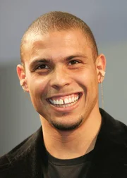 <b>Ronaldo Nazário:</b> A falha que existia entre os dentes incisivos centrais era a marca registrada do ex-jogador. Em 2008, o Fenômeno fez uma cirurgia a laser e colocou próteses de porcelana para ter um novo sorriso <b>Ronaldo Nazário:</b> A falha que existia entre os dentes incisivos centrais era a marca registrada do ex-jogador. Em 2008, o Fenômeno fez uma cirurgia a laser e colocou próteses de porcelana para ter um novo sorriso