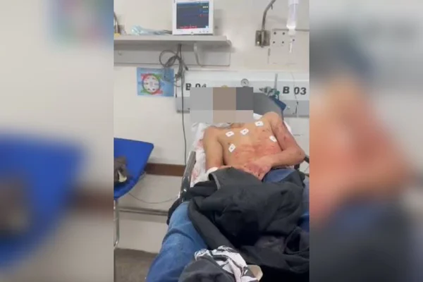 No DF, irmãos esfaqueiam homem na cabeça após esbarrão na rua