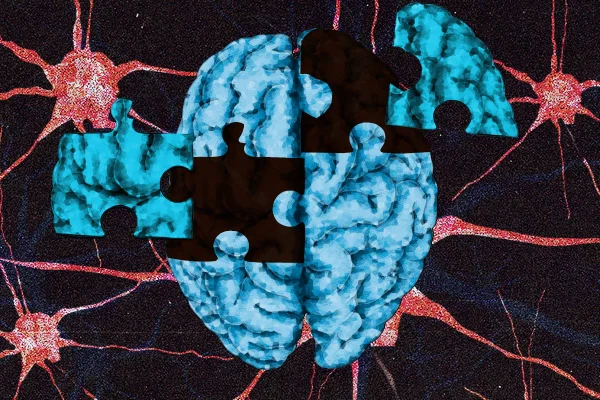 Ilustração de um cérebro na cor azul e neurônios ao fundo. Metrópoles