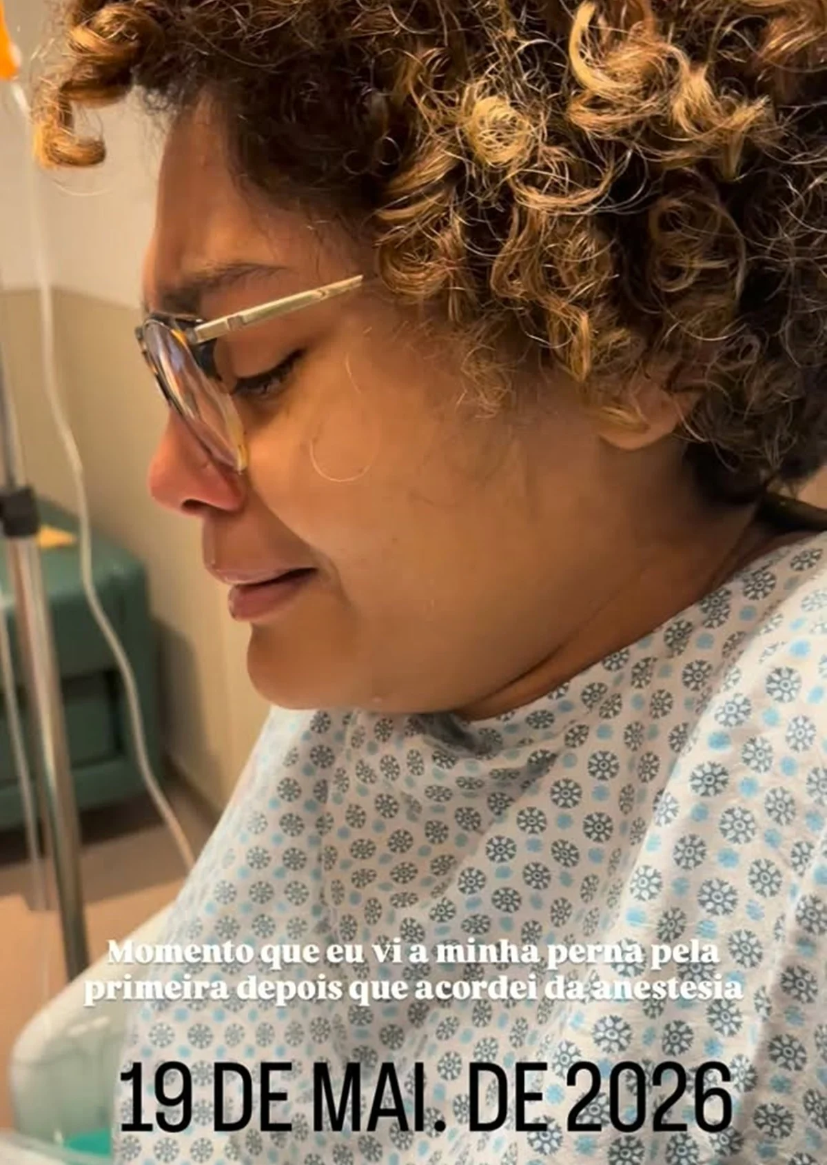 Barbara Reis mostra reação ao ver a perna após a operação Barbara Reis mostra reação ao ver a perna após a operação