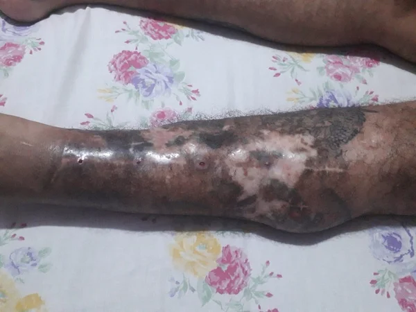 Homem aguarda cirurgia no DF (1)