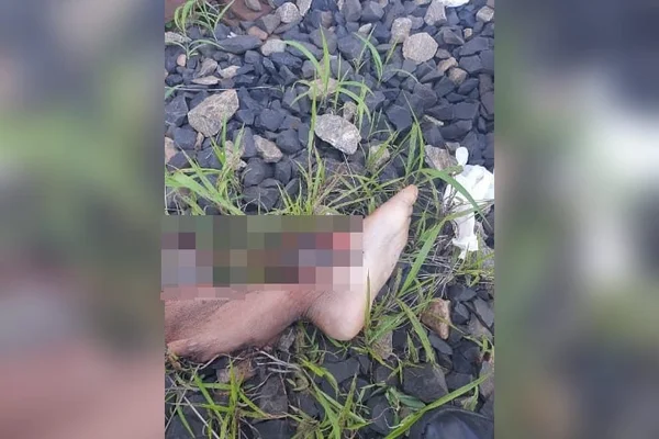 goias criança perna decepada trem