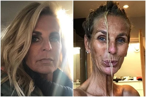 Viciada em tomar sol, apresentadora de TV posta foto pós-banho e choca web