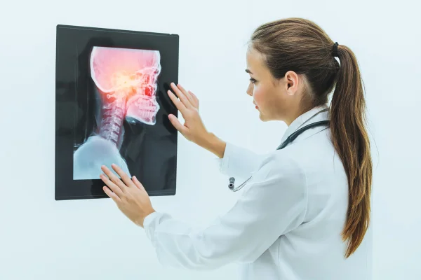Médica trabalhando com raio-X da cabeça do paciente e diagnosticando lesão no crânio. Conceito de câncer de cabeça e pescoço