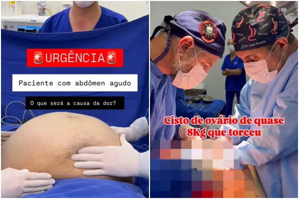 Duas fotos de médicos em sala de cirurgia - Metrópoles