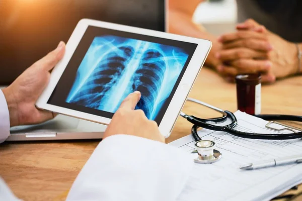 médico e paciente com raio x câncer de pulmão