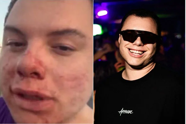 Imagem colorida mostra Clóvis Roberto de Leão, influencer internado após agressão no Economíadas. Metrópoles