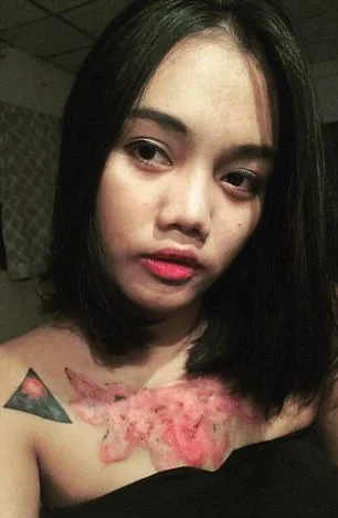 Garota relata momentos de dor ao remover tatuagem com método polêmico - imagem 14 Garota relata momentos de dor ao remover tatuagem com método polêmico - imagem 14