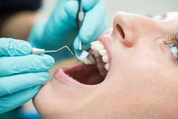 Foto colorida de uma mulher no dentista de boca aberta - Metrópoles