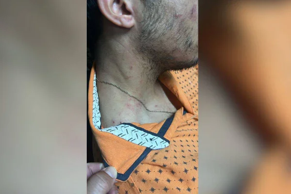 Amarrado, agredido com murros e coronhadas e abandonado no meio do mato por dois criminosos. Estes foram os relatos vividos por um motorista de aplicativo que foi alvo de sequestro na noite da última sexta-feira (30/8), na quadra 405 do Recando das Emas. O crime que gerou perseguição policial e capotamento do veículo de trabalho, terminou com a morte dos sequestradores após os suspeitos confrontarem a Polícia Militar do Estado de Goiás (PMGO), na Cidade Ocidental (GO), Entorno do Distrito Federal.
