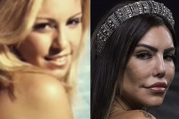 Antes e depois Liziane Gutierrez