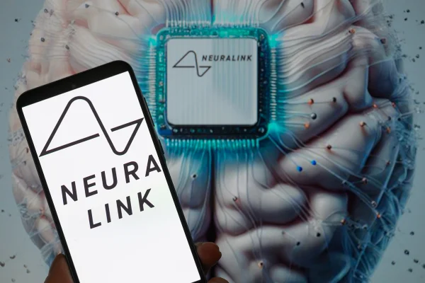 Ilustração colorida mostra cérebro com chip cerebral da Neuralink - Metrópoles