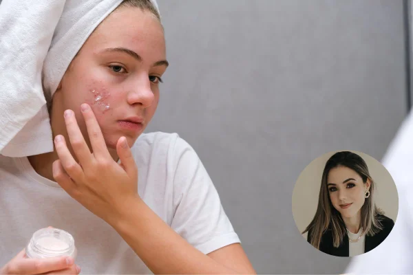 Mulher branca está com uma toalha na cabeça e observando suas acnes no espelho