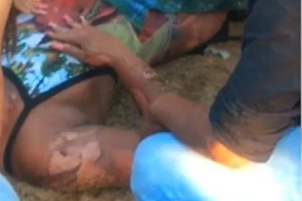 Churrasqueira explode durante evento e atinge cinco pessoas no ES