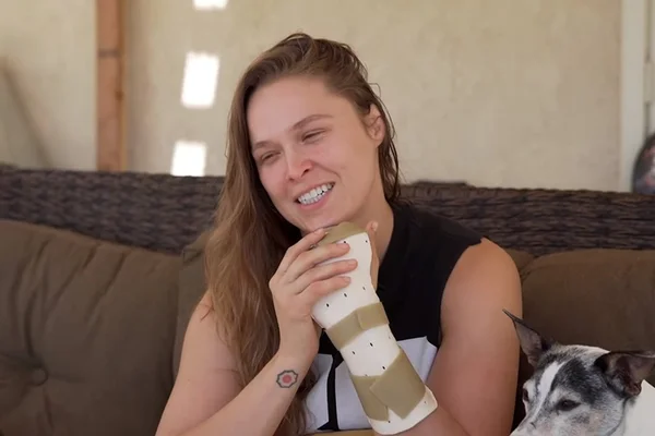 Ronda Rousey mostra como ficou dedo decepado após acidente em gravação