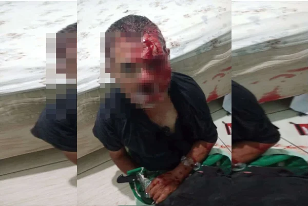 Torturadora mascarada desfigurou vítima com faca e isqueiro no DF
