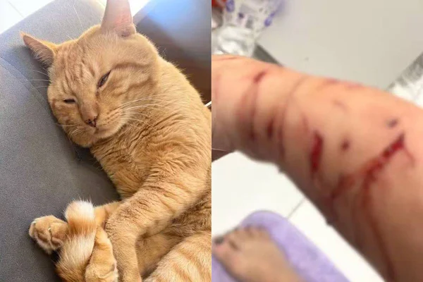 Caso Thor: gato que dilacerou o braço de tutora em São Vicente foi diagnosticado com desconforto emocional por causa de Síndrome de Pandora - Metrópoles