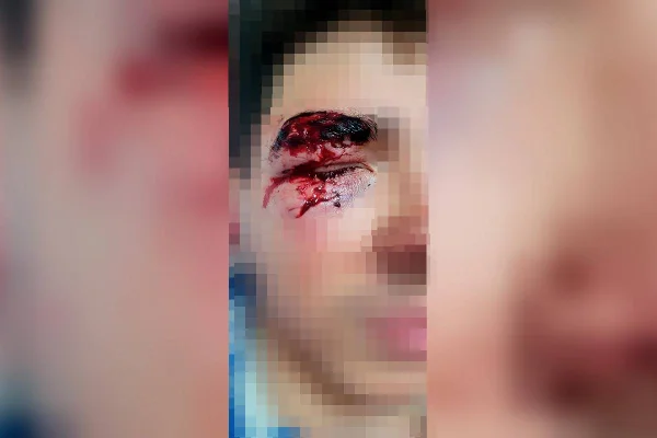 Adolescente fica gravemente ferido após ser atacado por homem em situação de rua em Águas Claras - Metrópoles
