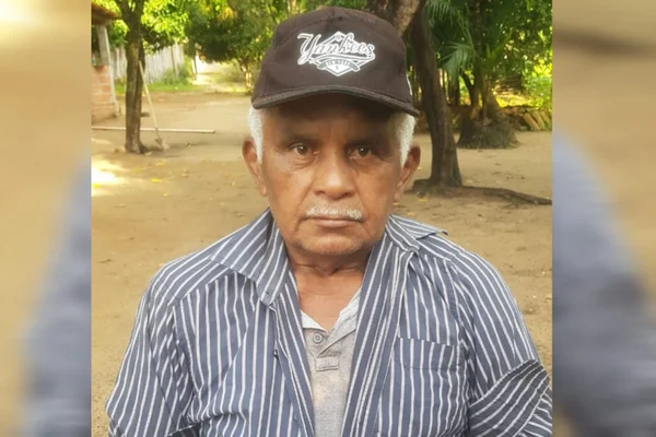 Homem com ATTR-PN AVC doença rara 2
