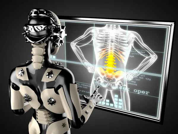 Aluna da UnB precisa de você para construir robô na Suécia