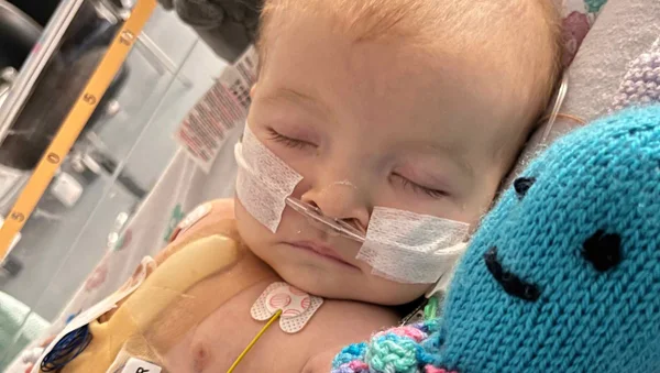 Foto mostra bebê com equipamentos médicos no corpo. Trata-se de Ava-Rose Lake, bebê com malformação cardíaca descoberta através do ronco - Metrópoles