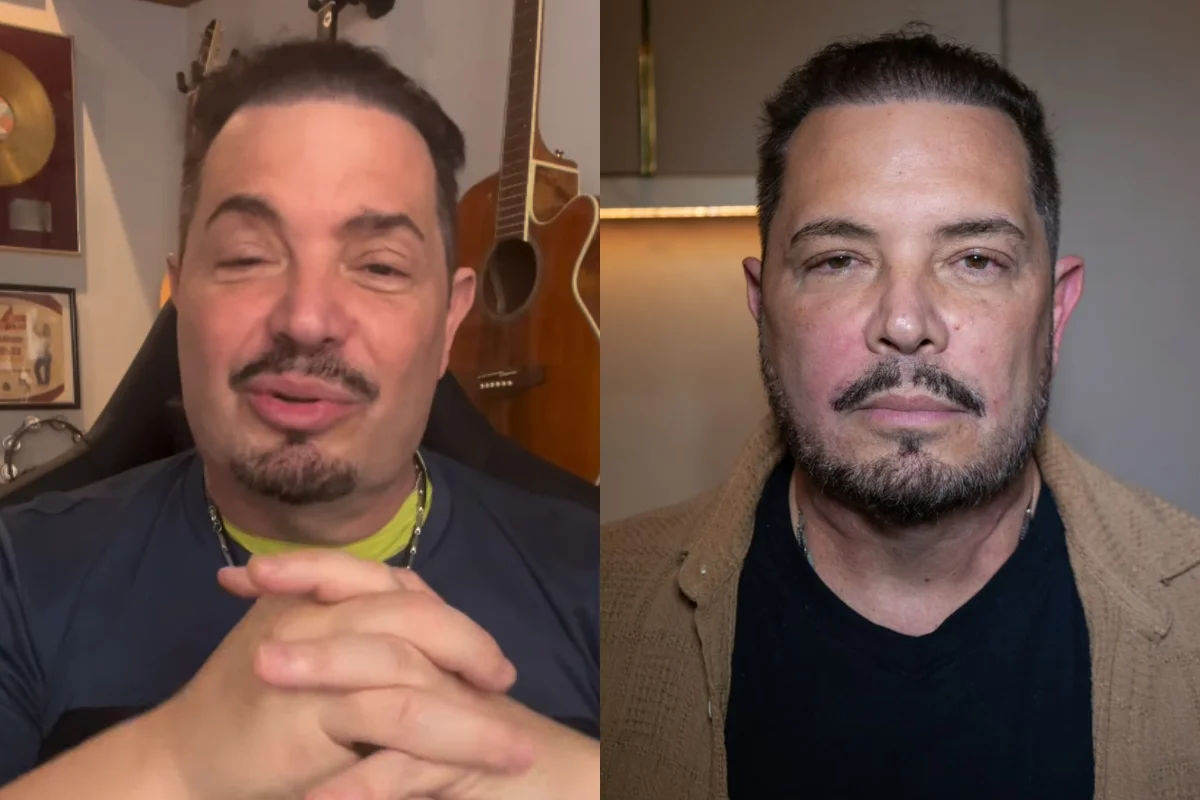 Antes e depois de Conrado Antes e depois de Conrado