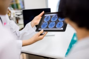 Quando maligno, o paciente passa a ser diagnosticado com câncer cerebral, que, por sua vez, costuma ser mais letal devido ao diagnóstico tardio. Geralmente, o paciente não desconfia dos sintomas iniciais e procura o médico quando a doença já progrediu