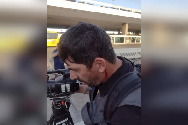 homem de lado com fio de sangue saindo de trás da orelha