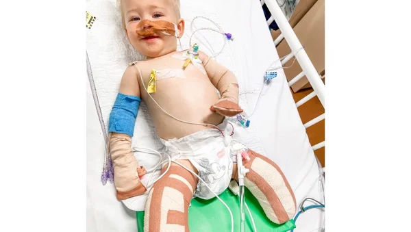 Imagem colrodiade bebê deitado em maca de hospital com mãos e pés amputados - Metrópoles