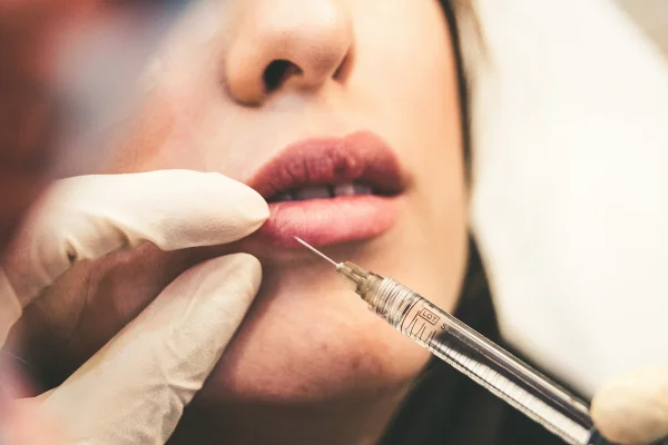 Síndrome da Face Hiperpreenchida gera alerta sobre excessos na beleza