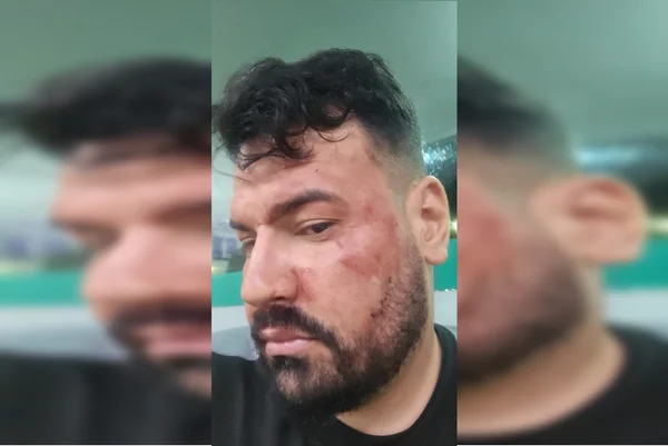 Home acusa militares do DF de agressão em abordagem