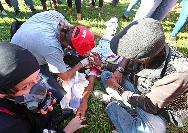 Filho de aposentado baleado em protesto chama PMs de “despreparados”