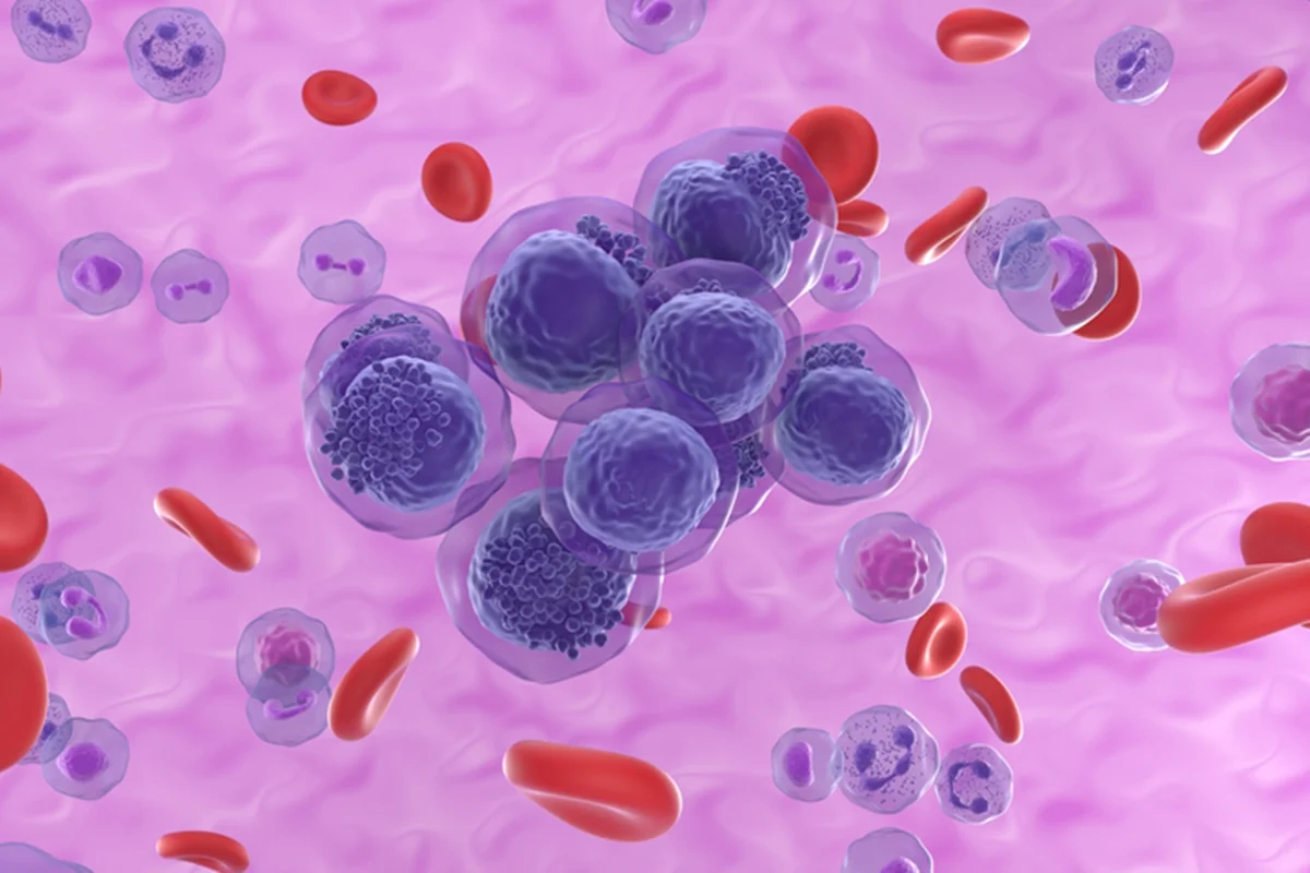 INCA projeta 12,2 mil novos casos de leucemia por ano no Brasil até 2028