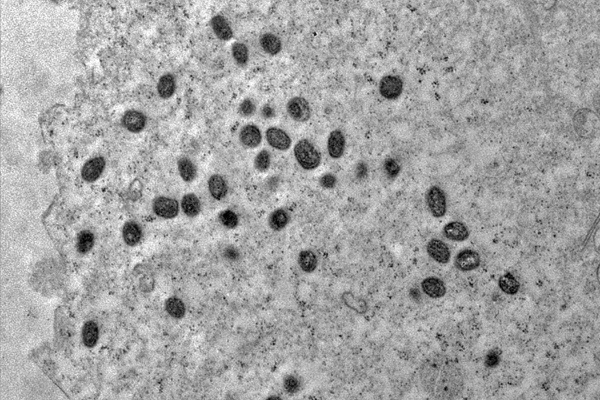 Imagem em preto e branco ddo vírus da monkeypox visto pelo microscópio - Metrópoles