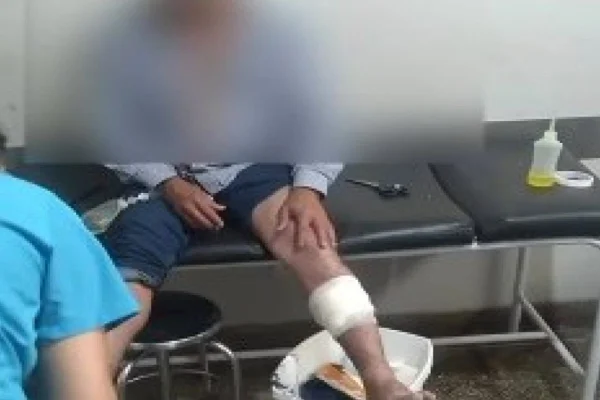 Imagem colorida, homem com a perna machucada no consultório - Metrópoles
