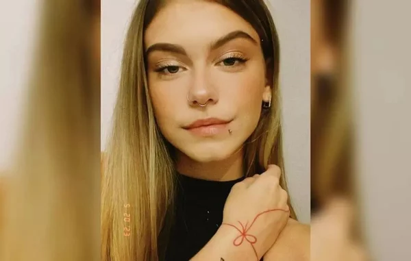 Imagem da universitária Dâmilly Beatriz. Jovem de 18 anos morre após ser infectada por bactéria via acne - Metrópoles