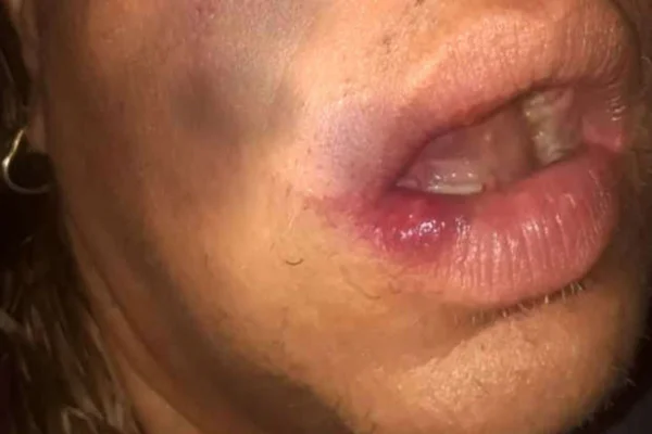 Travesti é atacada por dupla em MS: “Vai apanhar para virar homem”