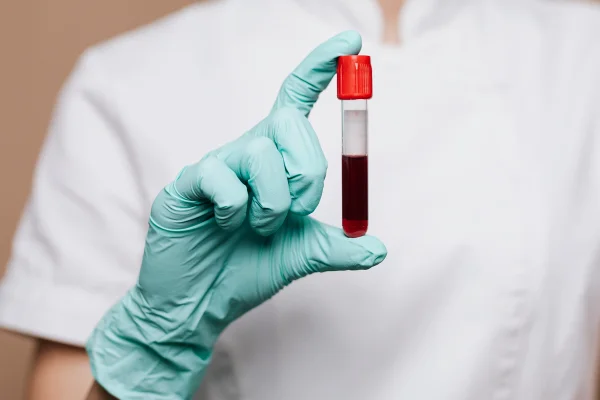 Foto colorida de uma pessoa com jaleco branco segurando um tubo com sangue humano. Metrópoles