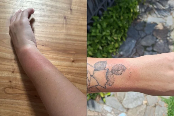Fãs relatam queimaduras por pulseiras após show de Luan Santana em BH